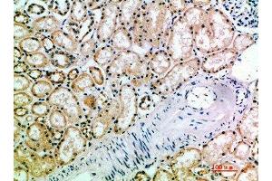 Immunohistochemical analysis of paraffin-embedded human-kidney, antibody was diluted at 1:200 (KIR3DL2 antibody  (AA 221-270))