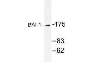 Image no. 1 for anti-Brain-Specific Angiogenesis Inhibitor 1 (BAI1) antibody (ABIN317742) (BAI1 antibody)