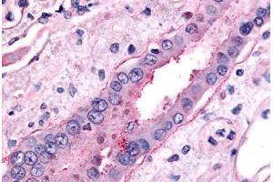 Anti-SLC5A2 antibody  ABIN1049344 IHC staining of human kidney, collecting duct. (SLC5A2 antibody  (C-Term))