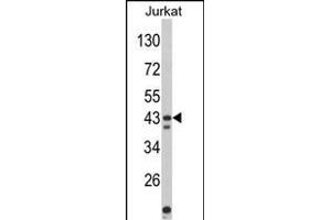 Western blot analysis of CECR5 Antibody (Center) (ABIN652500 and ABIN2842336) in Jurkat cell line lysates (35 μg/lane). (CECR5 antibody  (AA 164-190))
