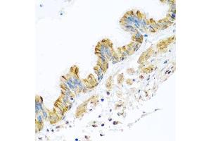 Immunohistochemistry of paraffin-embedded human trachea using PCDHA12 antibody. (PCDHA12 antibody  (AA 713-792))