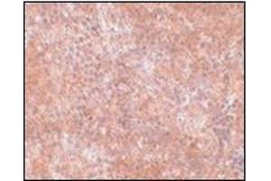 Immunohistochemistry of JMJD8 in mouse spleen tissue with this product at 2. (JMJD8 antibody  (C-Term))