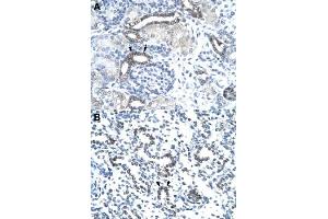 Immunohistochemical staining (Formalin-fixed paraffin-embedded sections) of human kidney (A) and human lung (B) with EVX1 polyclonal antibody  at 4-8 ug/mL working concentration. (EVX1 antibody  (N-Term))