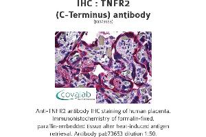 Image no. 1 for anti-Tumor Necrosis Factor Receptor Superfamily, Member 1B (TNFRSF1B) (C-Term) antibody (ABIN1740187) (TNFRSF1B antibody  (C-Term))
