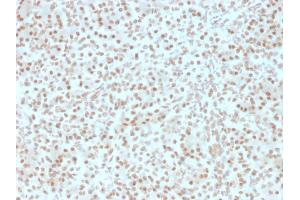 Formalin-fixed, paraffin-embedded human Pancreas stained with AKT1 Mouse Monoclonal Antibody (AKT1/2491). (AKT1 antibody  (AA 85-189))