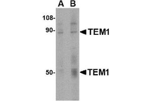 Western blot analysis of TEM1 in human colon tissue lysate with this product at (A) 0. (CD248 antibody  (C-Term))