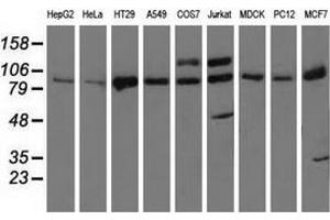 Western blot analysis of extracts (35 µg) from 9 different cell lines by using anti-PRKD2 monoclonal antibody. (PKD2 antibody)