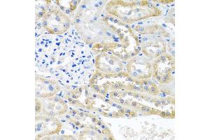 Immunohistochemistry of paraffin-embedded rat kidney using OGFR antibody at dilution of 1:100 (x40 lens). (OGFR antibody)