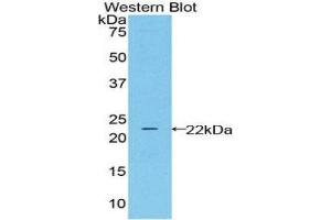 Western Blotting (WB) image for anti-Lipocalin 2 (LCN2) (AA 21-198) antibody (ABIN3206734) (Lipocalin 2 antibody  (AA 21-198))