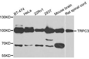 Western blot analysis of extracts of various cell lines, using TRPC3 antibody. (TRPC3 antibody)