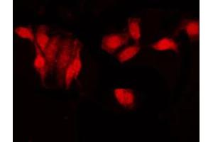 ABIN6266504 staining HeLa by IF/ICC. (JUP antibody  (C-Term))