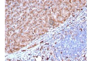Immunohistochemistry (IHC) image for anti-Cathepsin D (CTSD) (AA 104-250) antibody (ABIN6939215)