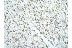 Rabbit Anti-RBM7 antibody   Paraffin Embedded Tissue: Human Heart cell Cellular Data: cardiac cell of renal tubule Antibody Concentration: 4. (RBM7 antibody  (Middle Region))