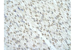 Rabbit Anti-RBM7 antibody   Paraffin Embedded Tissue: Human Heart cell Cellular Data: cardiac cell of renal tubule Antibody Concentration: 4.