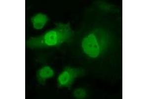 Anti-PPME1 mouse monoclonal antibody (ABIN2453492) immunofluorescent staining of COS7 cells transiently transfected by pCMV6-ENTRY PPME1 (RC200009). (PPME1 antibody)