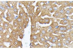 Immunohistochemistry (Paraffin-embedded Sections) (IHC (p)) image for anti-Nucleotide Binding Protein 1 (NUBP1) antibody (ABIN7259122)
