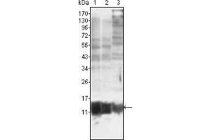 Western blot analysis using S100A10/P11 mouse mAb against MCF-7 (1), HepG2 (2) and Hela (3). (S100A10 antibody)