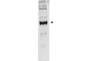 Western blot analysis is shown using  anti-bovine glutamate dehydrogenase antibody to detect the enzyme from bovine liver preparations. (GLUD1 antibody)