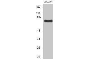 Western Blotting (WB) image for anti-Activating Transcription Factor 6 beta (ATF6B) (Internal Region) antibody (ABIN3183420)