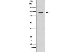 Western blot analysis of p95/NBS1 phosphorylation expression in Jurkat cell lysate treated with Etopside.