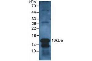 Detection of CLC in Human Leukocyte Cells using Polyclonal Antibody to Charcot Leyden Crystal Protein (CLC) (Galectin 10 antibody  (AA 2-142))