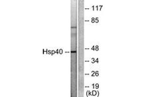 Western blot analysis of extracts from COLO205 cells, using HSP40 Antibody. (DNAJB1 antibody  (AA 271-320))