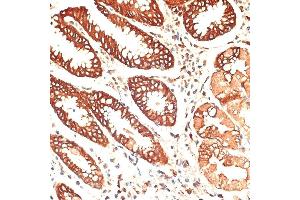 Immunohistochemistry of paraffin-embedded human stomach using Cytokeratin 13 (Cytokeratin 13 (KRT13)) antibody (ABIN7268090) at dilution of 1:100 (40x lens).