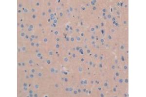 Figure. (GDF1 antibody  (AA 230-357))