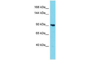 Host: Rabbit Target Name: KIAA1614 Sample Type: 721_B Whole Cell lysates Antibody Dilution: 1. (KIAA1614 antibody  (C-Term))