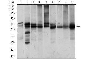 Western blot analysis using ILK mouse mAb against Jurkat (1), NIH3T3 (2), HeLa (3), PC-12 (4), C6 (5), COS7 (6), Raji (7), K562 (8) and MCF-7 (9) cell lysate. (ILK antibody  (AA 97-244))