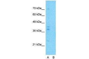 Host:  Rabbit  Target Name:  G6PC  Sample Type:  Human Fetal Lung  Lane A:  Primary Antibody  Lane B:  Primary Antibody + Blocking Peptide  Primary Antibody Concentration:  1ug/ml  Peptide Concentration:  5ug/ml  Lysate Quantity:  25ug/lane/lane  Gel Concentration:  0. (G6PC antibody  (N-Term))