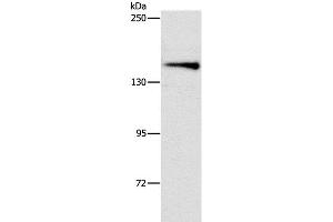 Western Blot analysis of Mouse brain tissue using ARHGEF11 Polyclonal Antibody at dilution of 1:1000 (ARHGEF11 antibody)