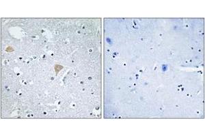 Immunohistochemistry analysis of paraffin-embedded human brain tissue, using CTRO Antibody. (CIT antibody  (AA 1011-1060))