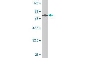 Western Blot detection against Immunogen (63. (STEAP1 antibody  (AA 1-339))