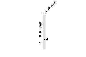 Anti-FNDC5 Antibody at 1:2000 dilution + human skeletal muscle lysate Lysates/proteins at 20 μg per lane. (FNDC5 antibody  (AA 12-152))