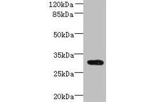 Western blot All lanes: CCDC127 antibody at 6 μg/mL + Mouse kidney tissue Secondary Goat polyclonal to rabbit IgG at 1/10000 dilution Predicted band size: 31 kDa Observed band size: 31 kDa (CCDC127 antibody  (AA 1-260))