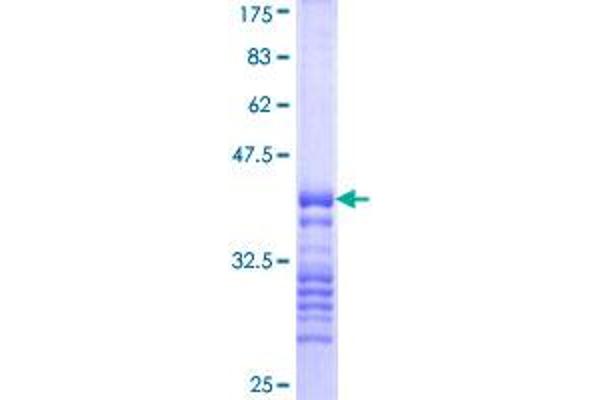 IRAK2 Protein (AA 111-210) (GST tag)