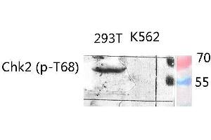 Western Blot (WB) analysis of specific lysis using Phospho-Chk2 (T68) Polyclonal Antibody.