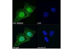 (ABIN6391406) Immunofluorescence analysis of paraformaldehyde fixed U2OS cells, permeabilized with 0. (Homeobox D13 antibody  (Internal Region))