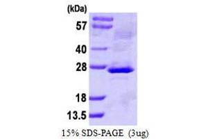 SDS-PAGE (SDS) image for Cardiotrophin-Like Cytokine Factor 1 (CLCF1) (AA 28-225) protein (His tag) (ABIN667531) (CLCF1 Protein (AA 28-225) (His tag))