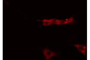 ABIN6268685 staining MCF-7 cells by IF/ICC.