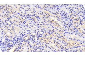 Detection of TNKS2 in Human Kidney Tissue using Polyclonal Antibody to Tankyrase 2 (TNKS2) (TNKS2 antibody)