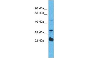 Western Blotting (WB) image for anti-Olfactory Receptor, Family 5, Subfamily D, Member 14 (OR5D14) (C-Term) antibody (ABIN2791753) (OR5D14 antibody  (C-Term))