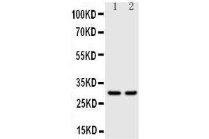 Anti-Kallikrein 1 antibody, Western blotting Lane 1: Rat Pancreas Tissue Lysate Lane 2: Rat Kidney Tissue Lysate (Kallikrein 1 antibody  (C-Term))