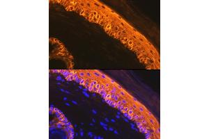 Immunofluorescence (IF) image for anti-Keratin 1 (KRT1) antibody (ABIN7268085)