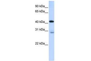 Image no. 1 for anti-GRAM Domain Containing 2 (GRAMD2) (AA 144-193) antibody (ABIN6740892)