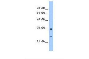 Image no. 1 for anti-Glutathione Transferase zeta 1 (Maleylacetoacetate Isomerase) (GSTZ1) (N-Term) antibody (ABIN321561) (GSTZ1 antibody  (N-Term))