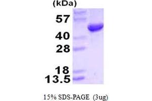 Hydroxymethylbilane Synthase (HMBS) (AA 1-361) protein (His tag)