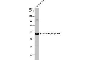 WB Image Rat tissue extract (50 μg) was separated by 10% SDS-PAGE, and the membrane was blotted with Fibrinogen gamma antibody , diluted at 1:500. (FGG antibody)