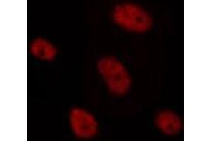 ABIN6275636 staining HepG2 by IF/ICC. (TCF4/12 antibody)
